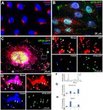 beta Amyloid Antibody in Immunocytochemistry (ICC/IF)