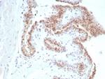 Androgen Receptor (Marker of Androgen Dependence) Antibody in Immunohistochemistry (Paraffin) (IHC (P))