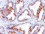 Androgen Receptor (Marker of Androgen Dependence) Antibody in Immunohistochemistry (Paraffin) (IHC (P))