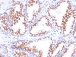 Androgen Receptor (Marker of Androgen Dependence) Antibody in Immunohistochemistry (Paraffin) (IHC (P))