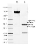 Androgen Receptor (Marker of Androgen Dependence) Antibody