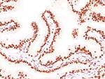 Androgen Receptor (Marker of Androgen Dependence) Antibody in Immunohistochemistry (Paraffin) (IHC (P))