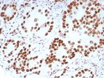 Androgen Receptor (Marker of Androgen Dependence) Antibody in Immunohistochemistry (Paraffin) (IHC (P))