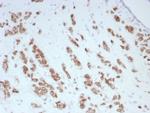 Androgen Receptor (Marker of Androgen Dependence) Antibody in Immunohistochemistry (Paraffin) (IHC (P))