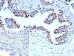 Androgen Receptor (Marker of Androgen Dependence) Antibody in Immunohistochemistry (Paraffin) (IHC (P))