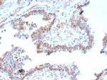 Androgen Receptor V7 (Marker of Androgen Dependence) Antibody in Immunohistochemistry (Paraffin) (IHC (P))