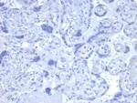 Androgen Receptor Antibody in Immunohistochemistry (Paraffin) (IHC (P))