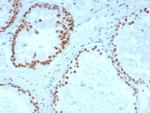 Androgen Receptor (Marker of Androgen Dependence) Antibody in Immunohistochemistry (Paraffin) (IHC (P))