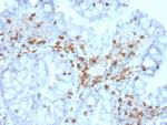 CD103/Integrin E7 Antibody in Immunohistochemistry (Paraffin) (IHC (P))