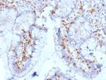 CD103/Integrin E7 Antibody in Immunohistochemistry (Paraffin) (IHC (P))