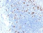 CD103/Integrin E7 Antibody in Immunohistochemistry (Paraffin) (IHC (P))