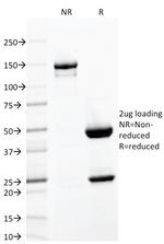 CD103/Integrin E7 Antibody in SDS-PAGE (SDS-PAGE)