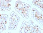 CD103/Integrin alpha E (T-Cell Lymphoma and Hairy Cell Leukemia Marker) Antibody in Immunohistochemistry (Paraffin) (IHC (P))