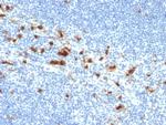 CD103/Integrin alpha E (T-Cell Lymphoma and Hairy Cell Leukemia Marker) Antibody in Immunohistochemistry (Paraffin) (IHC (P))