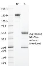 CD103/Integrin alpha E (T-Cell Lymphoma and Hairy Cell Leukemia Marker) Antibody in SDS-PAGE (SDS-PAGE)