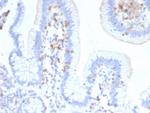 CD103/Integrin alpha E (T-Cell Lymphoma and Hairy Cell Leukemia Marker) Antibody in Immunohistochemistry (Paraffin) (IHC (P))