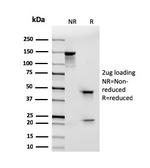 CD103/Integrin alpha-E-beta7 (T-Cell Lymphoma and Hairy Cell Leukemia Marker) Antibody in SDS-PAGE (SDS-PAGE)