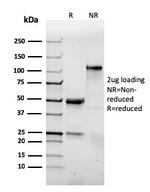 CD103/Integrin alpha-E-beta7 Antibody in SDS-PAGE (SDS-PAGE)