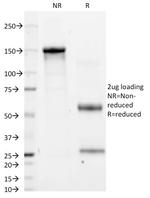 CD11a/Integrin L/LFA-1 Chain Antibody in SDS-PAGE (SDS-PAGE)