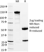 CD11a/Integrin L/LFA-1 Chain Antibody in SDS-PAGE (SDS-PAGE)