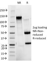 CD11b/MAC-1 (Microglial Marker) Antibody in SDS-PAGE (SDS-PAGE)