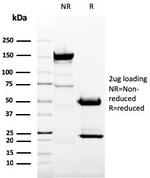 CD11b/MAC-1 (Microglial Marker) Antibody in SDS-PAGE (SDS-PAGE)