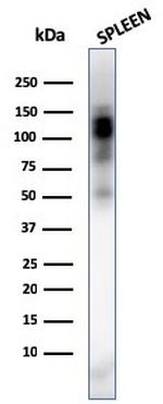 CD11b/MAC-1 Antibody in Western Blot (WB)