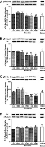 Phospho-Tyrosine Hydroxylase (Ser40) Antibody in Western Blot (WB)