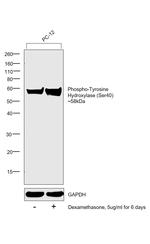 Phospho-Tyrosine Hydroxylase (Ser40) Antibody