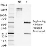 CD11c (Dendritic Cell Marker) Antibody in SDS-PAGE (SDS-PAGE)