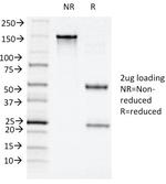 CD11c (Dendritic Cell Marker) Antibody in SDS-PAGE (SDS-PAGE)