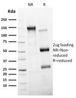 CD11c (Dendritic Cell Marker) Antibody in SDS-PAGE (SDS-PAGE)