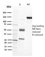 CD29 (Stem Cell Marker) Antibody in SDS-PAGE (SDS-PAGE)