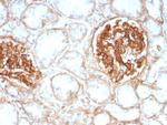 CD29 (Stem Cell Marker) Antibody in Immunohistochemistry (Paraffin) (IHC (P))