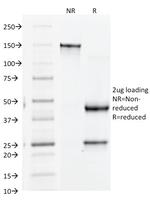 CD61/Integrin 3/Platelet Glycoprotein IIIa (Platelet Marker) Antibody in SDS-PAGE (SDS-PAGE)