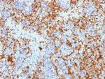 CD61/Integrin 3/Platelet Glycoprotein IIIa (Platelet Marker) Antibody in Immunohistochemistry (Paraffin) (IHC (P))