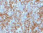 CD61/Integrin 3/Platelet Glycoprotein IIIa (Platelet Marker) Antibody in Immunohistochemistry (Paraffin) (IHC (P))