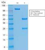 CD61/Integrin beta-3/Platelet Glycoprotein IIIa Antibody in SDS-PAGE (SDS-PAGE)