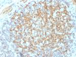 CD61/Integrin 3/Platelet Glycoprotein IIIa (Platelet Marker) Antibody in Immunohistochemistry (Paraffin) (IHC (P))