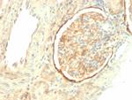 CD61/Integrin 3/Platelet Glycoprotein IIIa (Platelet Marker) Antibody in Immunohistochemistry (Paraffin) (IHC (P))