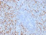 CD61/Integrin 3/Platelet Glycoprotein IIIa (Platelet Marker) Antibody in Immunohistochemistry (Paraffin) (IHC (P))