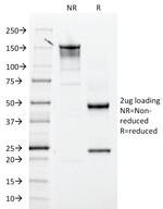 CD61/Integrin 3/Platelet Glycoprotein IIIa (Platelet Marker) Antibody in SDS-PAGE (SDS-PAGE)