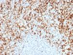 CD61/Integrin 3/Platelet Glycoprotein IIIa (Platelet Marker) Antibody in Immunohistochemistry (Paraffin) (IHC (P))