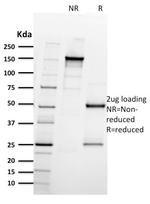 CD61/Integrin 3/Platelet Glycoprotein IIIa (Platelet Marker) Antibody in SDS-PAGE (SDS-PAGE)