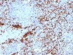 CD61/Integrin '3/Platelet Glycoprotein IIIa (Platelet Marker) Antibody in Immunohistochemistry (Paraffin) (IHC (P))