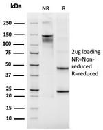 CD61/Integrin '3/Platelet Glycoprotein IIIa (Platelet Marker) Antibody in SDS-PAGE (SDS-PAGE)