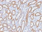 CD61/Integrin 3/Platelet Glycoprotein IIIa Antibody in Immunohistochemistry (Paraffin) (IHC (P))