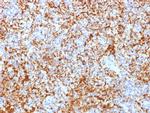 CD61/Integrin 3/Platelet Glycoprotein IIIa Antibody in Immunohistochemistry (Paraffin) (IHC (P))