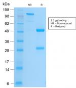 CD61/Integrin 3/Platelet Glycoprotein IIIa Antibody in SDS-PAGE (SDS-PAGE)