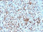 CD61/Integrin 3/Platelet Glycoprotein IIIa (Platelet Marker) Antibody in Immunohistochemistry (Paraffin) (IHC (P))